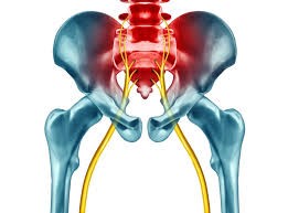 The Benefits of Chiropractic Care for Sciatica Sufferers