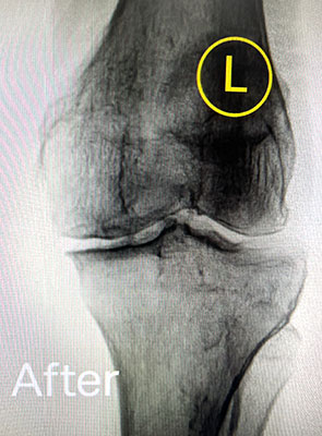 regenerative medicine after