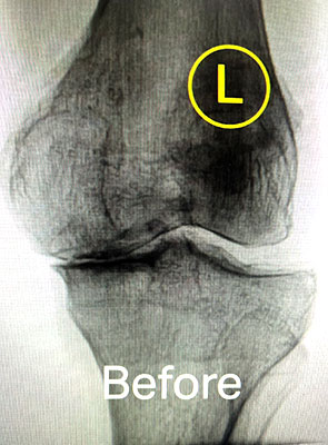 regenerative medicine before