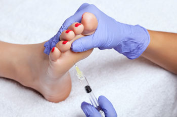 prp injection