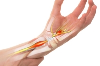 How a Chiropractor Can Help Ease Carpal Tunnel Discomfort